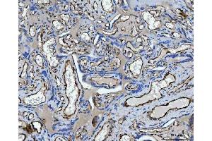 IHC analysis of TP53I13 using anti-TP53I13 antibody (ABIN7601220). (TP53I13 anticorps  (AA 30-365))