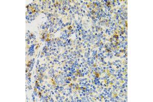 Immunohistochemistry of paraffin-embedded mouse spleen using SH2B1 Antibody (ABIN5973245) at dilution of 1/100 (40x lens). (SH2B1 anticorps)