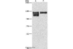 Western blot analysis of A172 cell and human leiomyosarcoma tissue, using ITGB1 Polyclonal Antibody at dilution of 1:600 (ITGB1 anticorps)