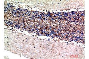 Immunohistochemistry (IHC) analysis of paraffin-embedded Human Brain, antibody was diluted at 1:200. (S100A1 anticorps)