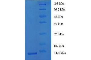 SDS-PAGE (SDS) image for Interleukin 8 (IL8) (AA 17-102), (partial) protein (His tag) (ABIN5712994)