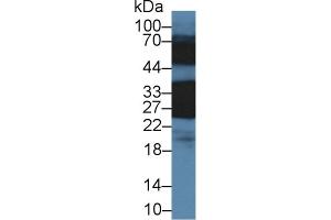 Detection of CRYbB1 in Rat Eye lysate using Polyclonal Antibody to Crystallin Beta B1 (CRYbB1) (CRYBB1 anticorps  (AA 6-186))
