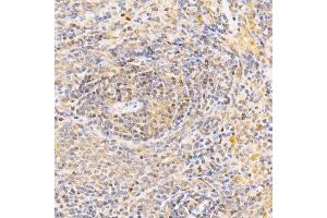 anti-Anaphase Promoting Complex Subunit 2 (ANAPC2) (AA 400-500) antibody