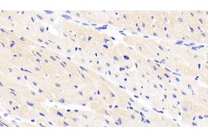 Detection of TNX in Human Cardiac Muscle Tissue using Polyclonal Antibody to Tenascin X (TNX) (TNXB anticorps  (AA 3835-4088))