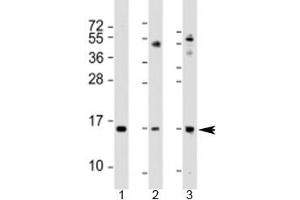 Western blot testing of 1) human A549 cell lysate, 2) mouse lung lysate and 3) mouse small intestine lysate with Phospholipase A2 antibody at 1:2000.