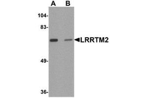 Western blot analysis of LRRTM2 in SK-N-SH cell lysate with LRRTM2 antibody at 1 μg/ml in (A) the absence and (B) the presence of blocking peptide.