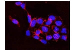 IF analysis of IKK beta using anti-IKK beta antibody (ABIN3042734).