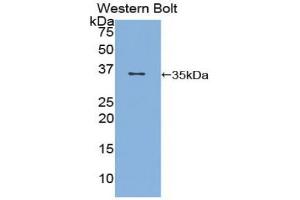Detection of Recombinant CD1d, Rat using Polyclonal Antibody to Cluster Of Differentiation 1d (CD1d) (CD1d anticorps  (AA 32-302))