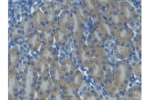 Detection of ITaC in Mouse Kidney Tissue using Polyclonal Antibody to Interferon Inducible T-Cell Alpha Chemoattractant (ITaC) (CXCL11 anticorps  (AA 22-100))