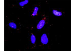 Proximity Ligation Analysis of protein-protein interactions between CBL and PLCG1. (CBL anticorps  (AA 1-906))