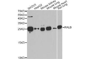 Western blot analysis of extracts of various cell lines, using RALB antibody. (RALB anticorps)