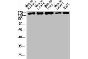 Western blot analysis of Mouse kidney tissue, Mouse brain tissue, Mouse lung tissue, Mouse heart tissue, 293T whole cell lysate, antibody was diluted at 1000. (Desmoglein 1 anticorps  (AA 30-90))