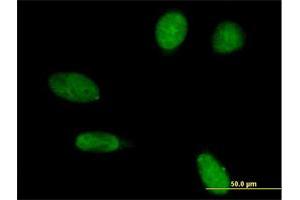 Immunofluorescence of purified MaxPab antibody to EMD on HeLa cell. (Emerin anticorps  (AA 1-254))