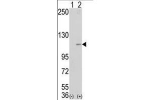 Western blot analysis of AOF2 (arrow) using LSD1 Antibody (Center) (ABIN388022 and ABIN2845464). (LSD1 anticorps  (AA 457-490))