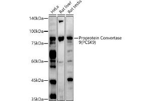 Western blot analysis of extracts of various cell lines, using Proprotein Convertase 9(PCSK9) antibody (ABIN6133851, ABIN6145328, ABIN6145330 and ABIN6223837) at 1:1000 dilution. (PCSK9 anticorps  (C-Term))