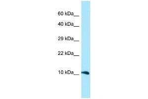 WB Suggested Anti-GGNBP1 Antibody Titration: 1. (GGNBP1 anticorps  (N-Term))