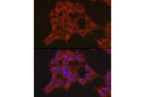 Immunofluorescence analysis of C6 cells using CCL3 Rabbit pAb (ABIN6130184, ABIN6138061, ABIN6138062 and ABIN6223474) at dilution of 1:100 (40x lens). (CCL3 anticorps  (AA 24-92))