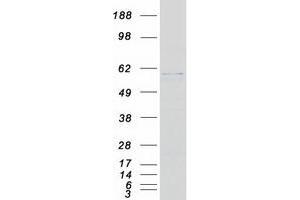 Validation with Western Blot
