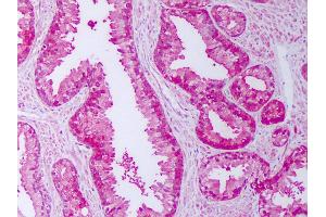 Anti-FKBP52 antibody IHC of human prostate.