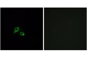 Immunofluorescence analysis of MCF7 cells, using GIPR Antibody. (GIPR anticorps  (AA 93-142))