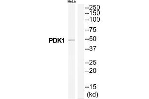 Western Blotting (WB) image for anti-3-phosphoinositide Dependent Protein Kinase-1 (PDPK1) (Internal Region) antibody (ABIN1851913) (PDPK1 anticorps  (Internal Region))