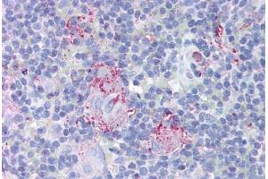 Human Thymus (formalin-fixed, paraffin-embedded) stained with MTBP antibody ABIN213954 at 10 ug/ml followed by biotinylated goat anti-rabbit IgG secondary antibody ABIN481713, alkaline phosphatase-streptavidin and chromogen. (MTBP anticorps  (AA 122-139))