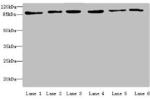 Western blot All lanes: MCM3 antibody at 4 μg/mL Lane 1: Hela whole cell lysate Lane 2: 293T whole cell lysate Lane 3: K562 whole cell lysate Lane 4: HepG2 whole cell lysate Lane 5: Jurkats whole cell lysate Lane 6: U917 whole cell lysate Secondary Goat polyclonal to rabbit IgG at 1/10000 dilution Predicted band size: 91, 96 kDa Observed band size: 91 kDa