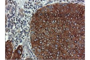 Image no. 1 for anti-Farnesyl-Diphosphate Farnesyltransferase 1 (FDFT1) antibody (ABIN1498243)