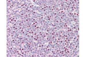 Anti-RAD51B antibody IHC staining of human tonsil. (RAD51 Homolog B anticorps  (AA 143-192))