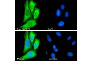 (ABIN185257) Immunofluorescence analysis of paraformaldehyde fixed HeLa cells, permeabilized with 0.