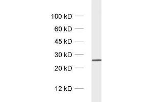 dilution: 1 : 1000, sample: crude synaptosomal fraction of rat brain (P2)