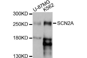 Western blot analysis of extracts of U-87MG and K562 cells, using SCN2A antibody.