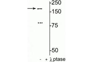 Western blot of rat hippocampal lysate showing specific immunolabeling of the ~180 kDa NR2B subunit of the NMDAR phosphorylated at Tyr1472 in the first lane (-). (GRIN2B anticorps  (pTyr1472))