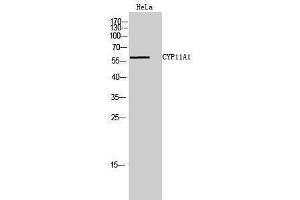 Western Blotting (WB) image for anti-Cytochrome P450, Family 11, Subfamily A, Polypeptide 1 (CYP11A1) (C-Term) antibody (ABIN3184157) (CYP11A1 anticorps  (C-Term))