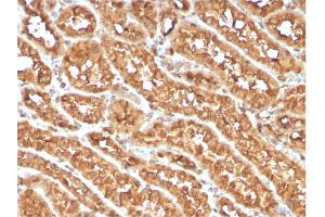 Formalin-fixed, paraffin-embedded human Renal Cell Carcinoma stained with OX40 Mouse Monoclonal Antibody (OX40/3108).