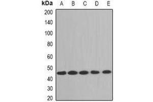Western blot analysis of Aminoacylase 1 expression in A431 (A), Jurdat (B), mouse brain (C), mouse liver (D), rat kidney (E) whole cell lysates. (Aminoacylase 1 anticorps)