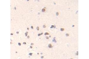 Figure. (SPIN3 anticorps  (AA 1-77))