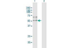 Western Blot analysis of ENTPD1 expression in transfected 293T cell line by ENTPD1 MaxPab polyclonal antibody. (CD39 anticorps  (AA 1-510))