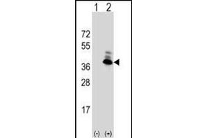 Western blot analysis of AS (arrow) using rabbit polyclonal AS Antibody (N-term) (ABIN390843 and ABIN2841069).