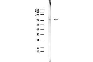 anti-Sodium Channel and Clathrin Linker 1 (Sclt1) antibody