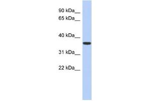 WB Suggested Anti-MVK Antibody Titration: 0. (MVK anticorps  (N-Term))