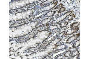 IHC analysis of PRDM5 using anti-PRDM5 antibody (ABIN7600853). (PRDM5 anticorps  (AA 24-630))