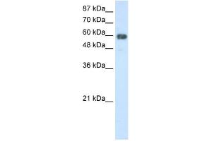 WB Suggested Anti-TROVE2 Antibody Titration:  2. (TROVE2 anticorps  (N-Term))