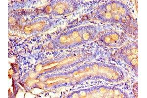 Immunohistochemistry of paraffin-embedded human small intestine tissue using ABIN7159734 at dilution of 1:100 (MTTP anticorps  (AA 19-151))