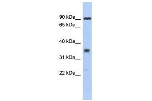 C6ORF154 antibody used at 1 ug/ml to detect target protein. (C6orf154 anticorps  (Middle Region))
