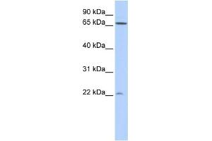 WB Suggested Anti-DIRAS1 Antibody Titration: 0. (DIRAS1 anticorps  (N-Term))
