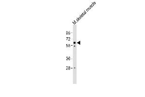 Anti-Smarcd3 Antibody (Center) at 1:4000 dilution + mouse skeletal muscle lysates Lysates/proteins at 20 μg per lane. (SMARCD3 anticorps  (AA 158-193))