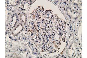 Immunohistochemical staining of paraffin-embedded Human Kidney tissue using anti-OGFOD1 mouse monoclonal antibody. (OGFOD1 anticorps)