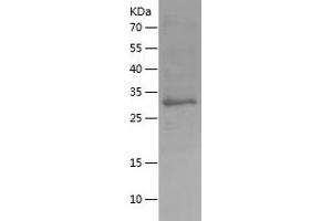 Western Blotting (WB) image for Hepcidin Antimicrobial Peptide (HAMP) (AA 23-83) protein (His-IF2DI Tag) (ABIN7123313)