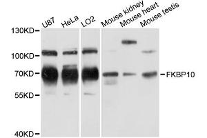 Western blot analysis of extracts of various cell lines, using FKBP10 antibody (ABIN6290381) at 1:3000 dilution.
